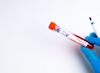 V Evropi potrdili prvi primer opičjih koz